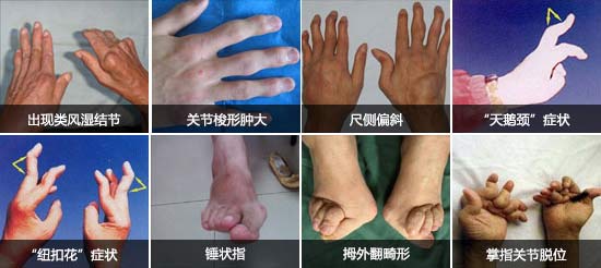 Fꖏ(qing)ֱt(y)ԺL(fng)ָ_ֺȶ̎P(gun)(ji).jpg