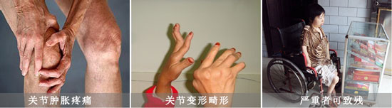 Fꖏ(qing)ֱt(y)ԺL(fng)(hu)(do)P(gun)(ji)[ʹ.jpg