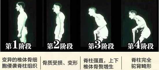F(yng)(qing)ֱt(y)Ժ(qing)ֱԼ׳ʹYҕ(hu)P(gun)(ji)׃Σ.jpg