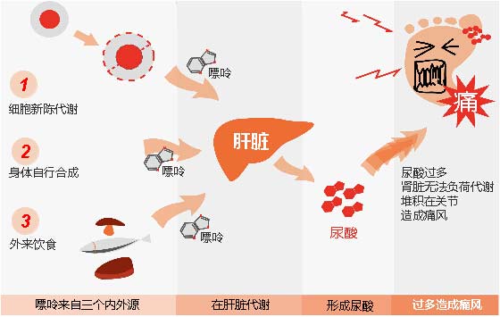 貴陽強(qiáng)直醫(yī)院痛風(fēng)形成原理.jpg